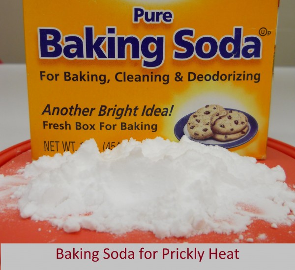 prickley heat_baking soda